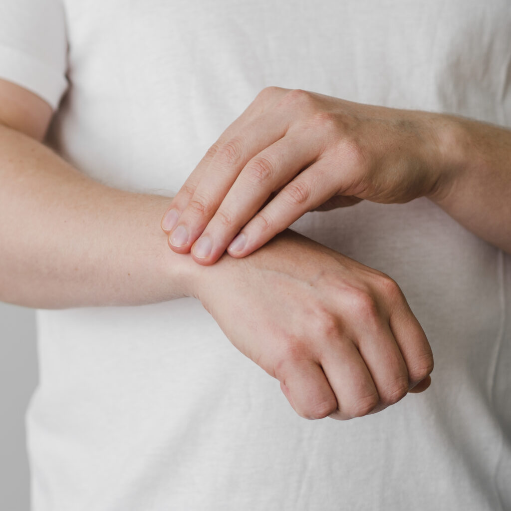 urticaria por estres
